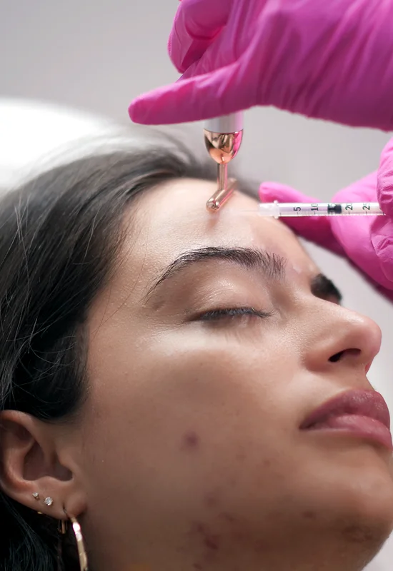 Botox Procedure Image